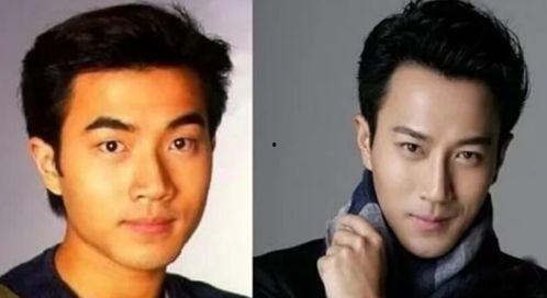 娱乐圈吃瓜爆料男星整容,男星整容风波,真相背后竟是这样...